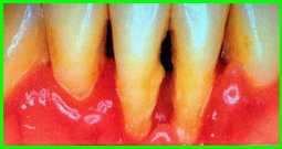 bett3.jpg (5076 Byte)