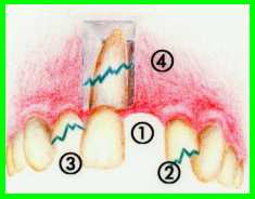 mundschutz3.jpg (6751 Byte)