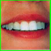 nacher.jpg (4220 Byte)