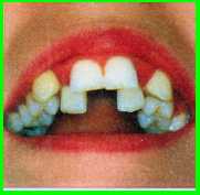 vorher.jpg (4872 Byte)